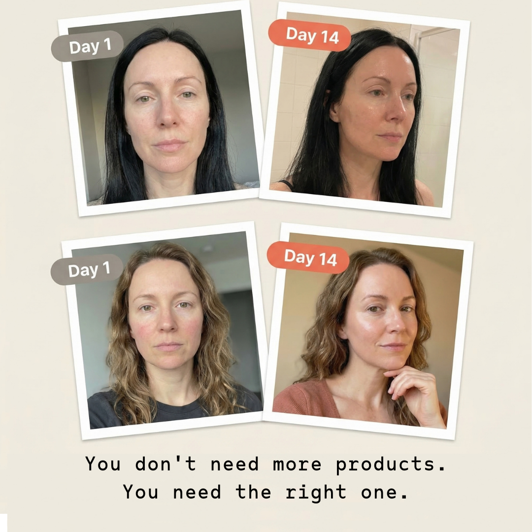 Before and after comparison of a woman's face with text 'You don't need more products. You need the right one.'